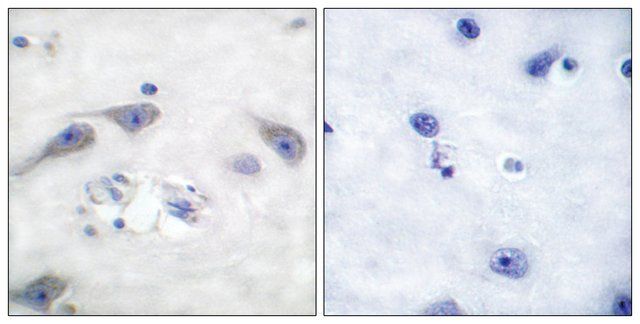 Anti-DARPP-32 antibody produced in rabbit