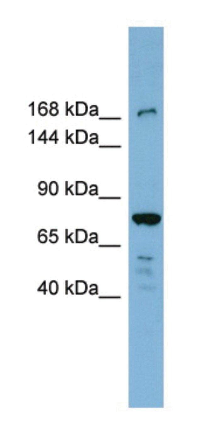 Anti-DAPK1 (N-terminal) antibody produced in rabbit