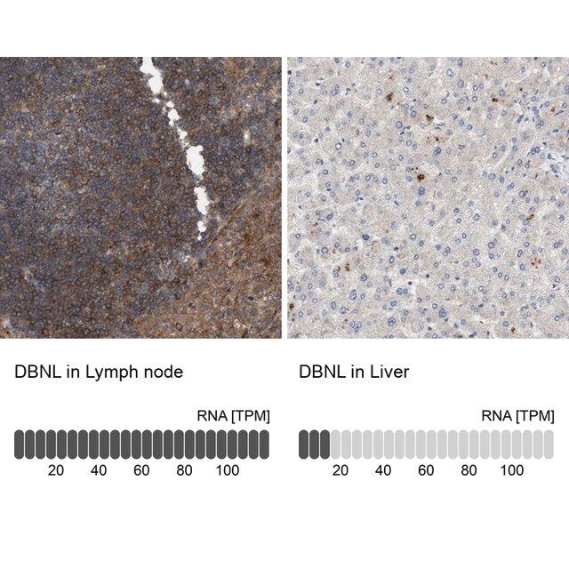 Anti-DBNL antibody produced in rabbit