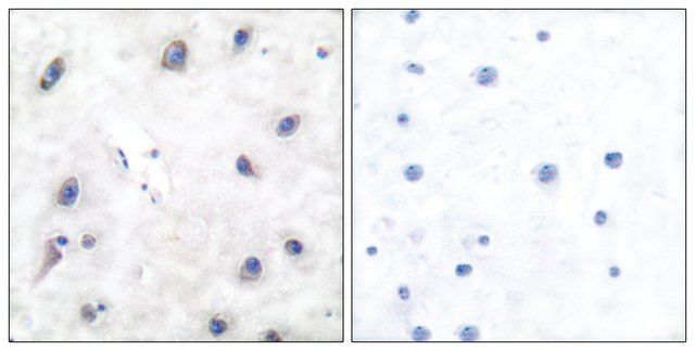 Anti-DARPP-32, N-Terminal antibody produced in rabbit