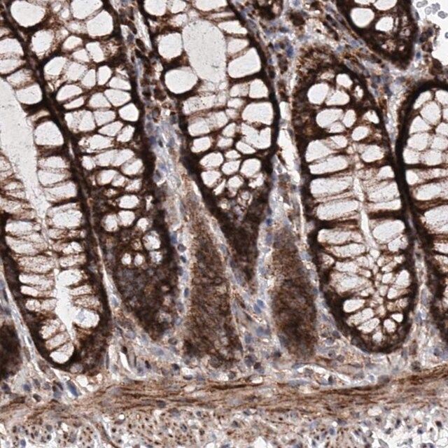 Anti-DAD1 antibody produced in rabbit