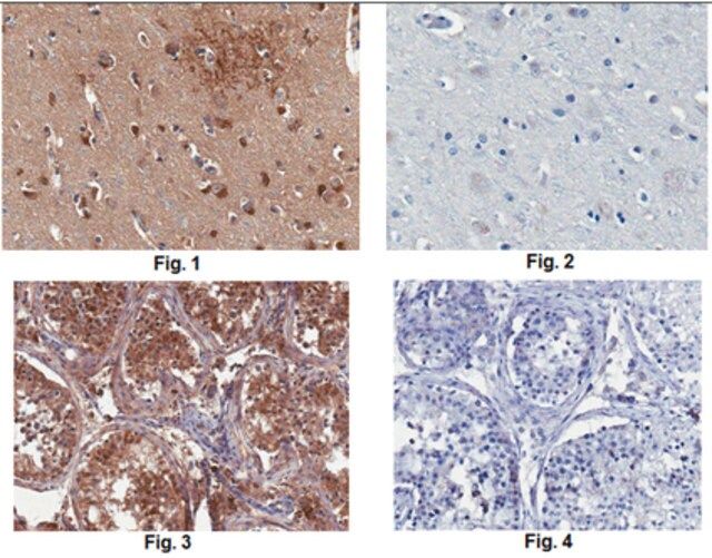 Anti-DARPP-32 Antibody, clone 9B6.1