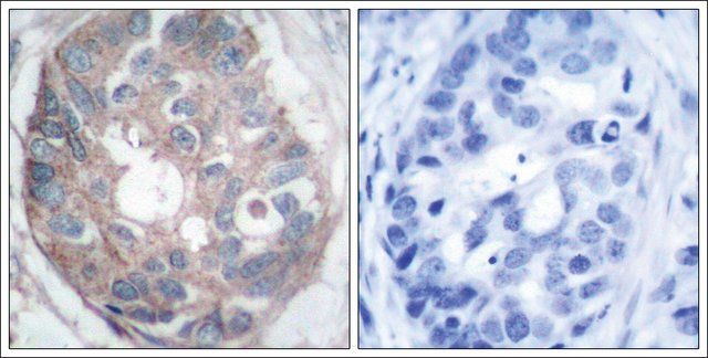 Anti-DAB1 (Ab-232) antibody produced in rabbit