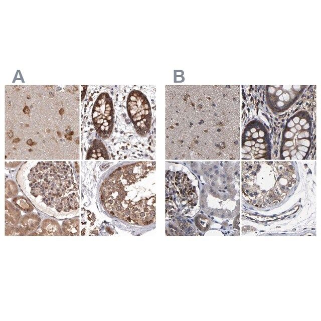 Anti-DARS antibody produced in rabbit