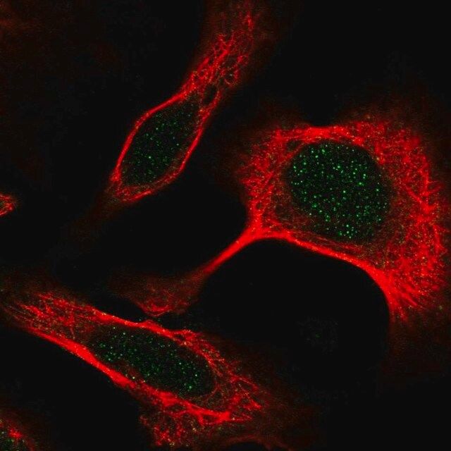 Anti-DAPK3 antibody produced in rabbit