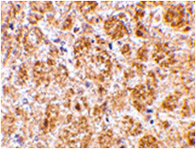 Anti-DARC Antibody