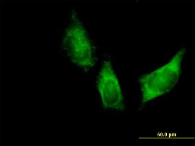 Anti-DARS antibody produced in mouse