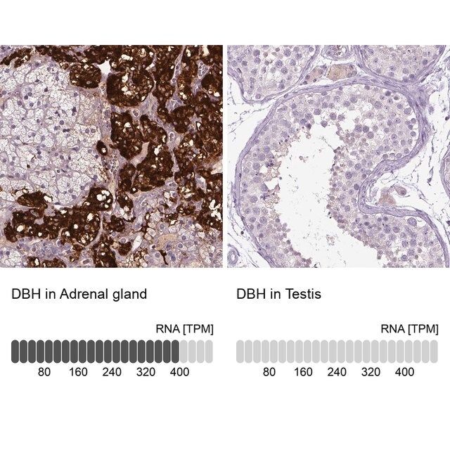 Anti-DBH antibody produced in rabbit