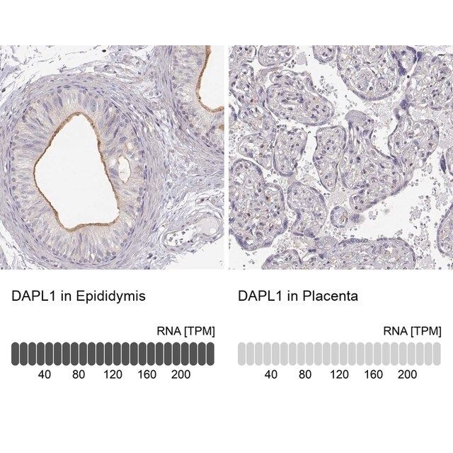 Anti-DAPL1 antibody produced in rabbit