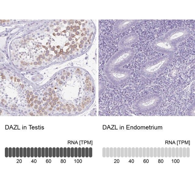 Anti-DAZL antibody produced in rabbit