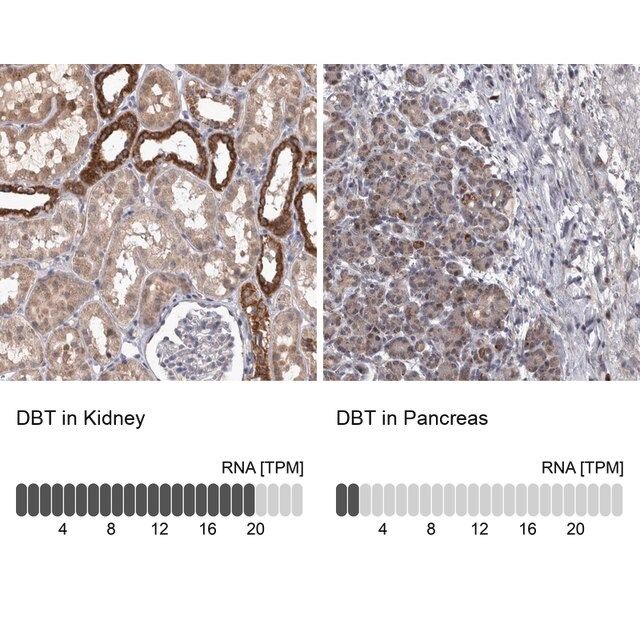 Anti-DBT antibody produced in rabbit