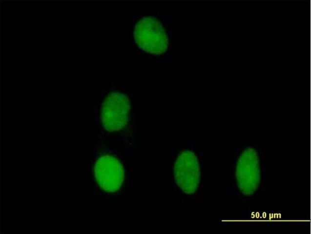 Anti-DBR1 antibody produced in mouse