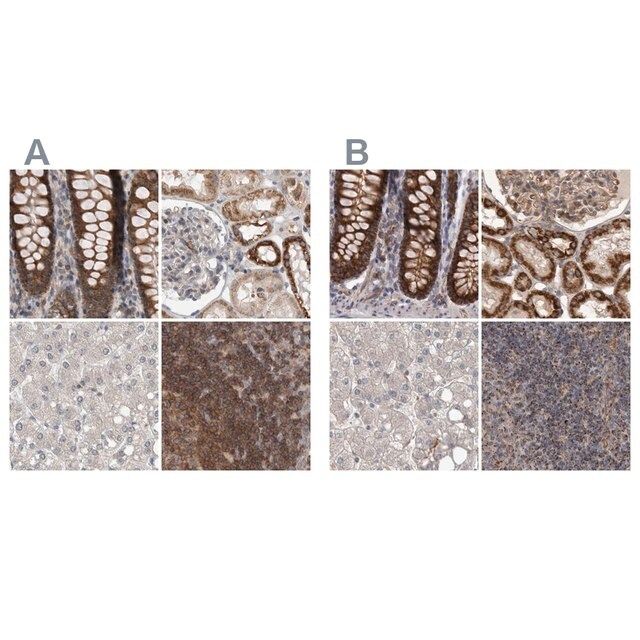 Anti-DARS2 antibody produced in rabbit