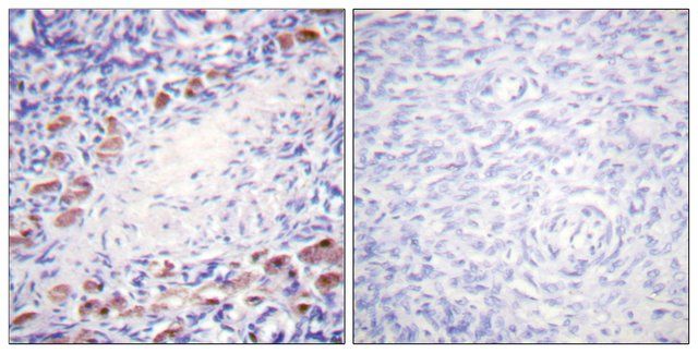 Anti-Daxx antibody produced in rabbit