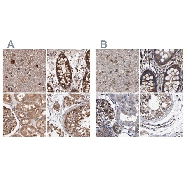 Anti-DARS antibody produced in rabbit