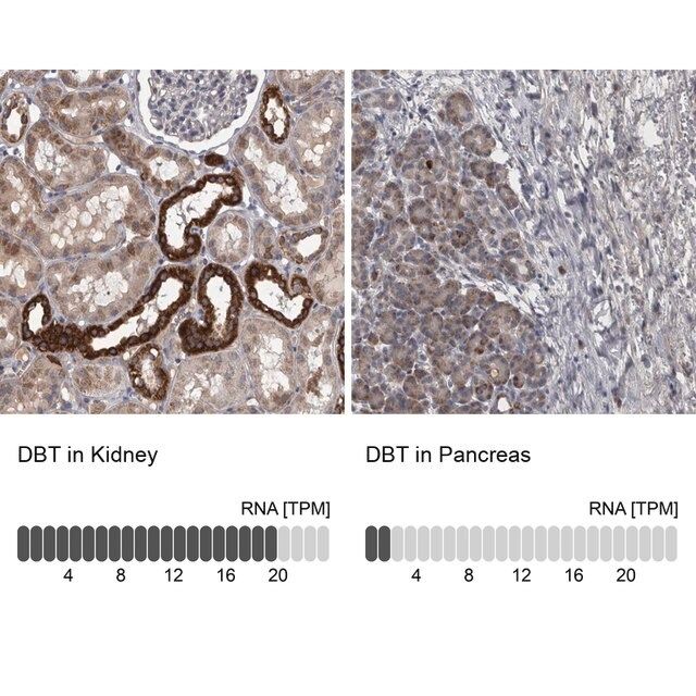 Anti-DBT antibody produced in rabbit