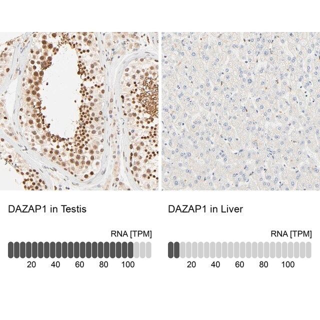 Anti-DAZAP1 antibody produced in rabbit