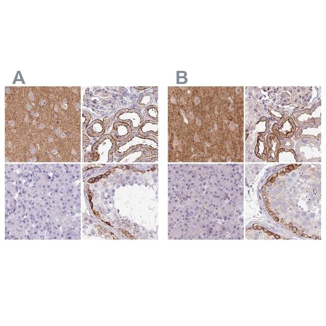 Anti-DBN1 antibody produced in rabbit