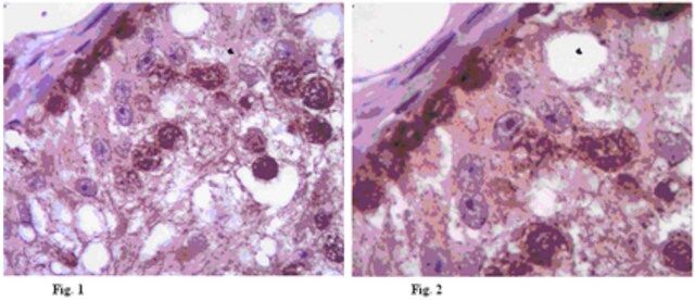 Anti-DAZ Antibody