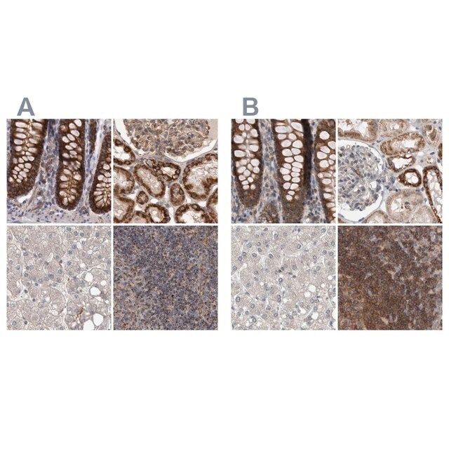 Anti-DARS2 antibody produced in rabbit