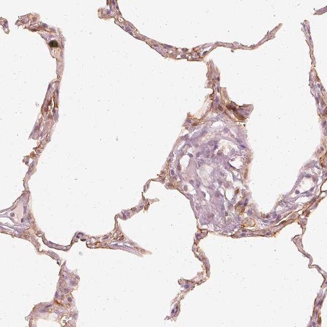 Anti-DAPP1 antibody produced in rabbit