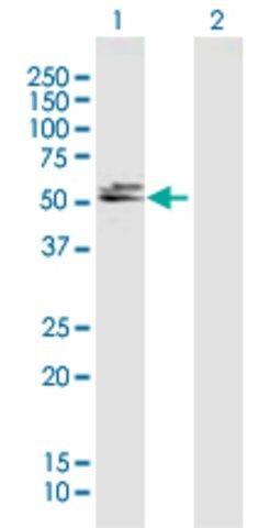 Anti-DBT antibody produced in mouse