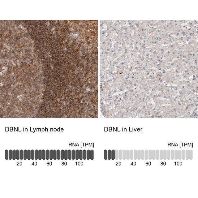 Anti-DBNL antibody produced in rabbit