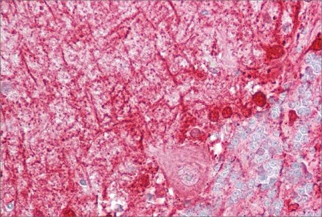 Anti-DBI antibody produced in rabbit