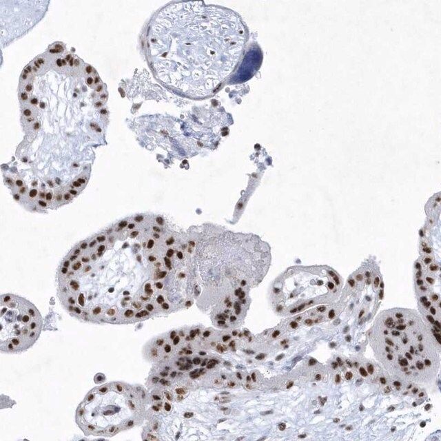 Anti-DCLRE1A antibody produced in rabbit