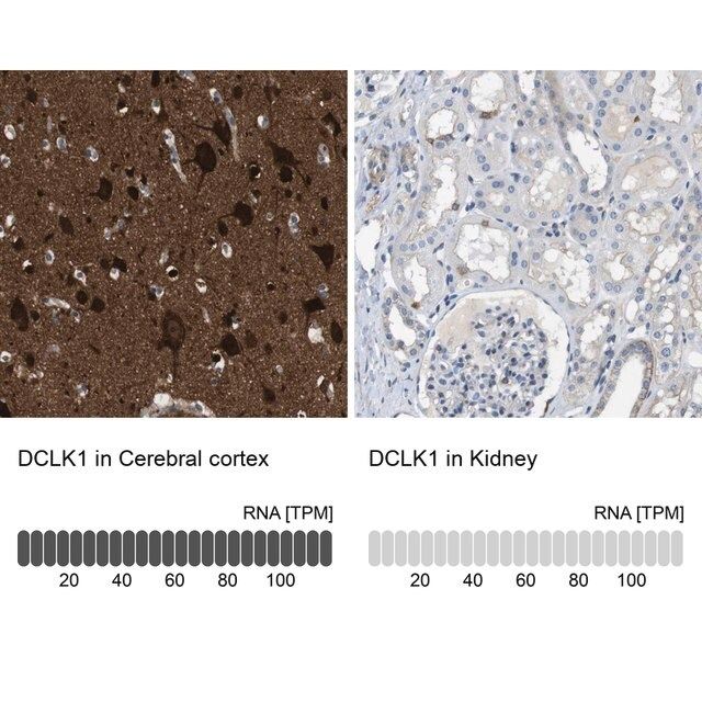 Anti-DCLK1 antibody produced in rabbit