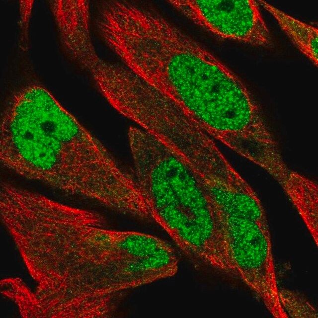 Anti-DCLRE1B antibody produced in rabbit