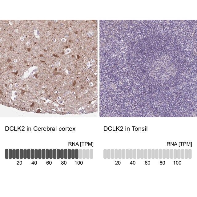 Anti-DCLK2 antibody produced in rabbit