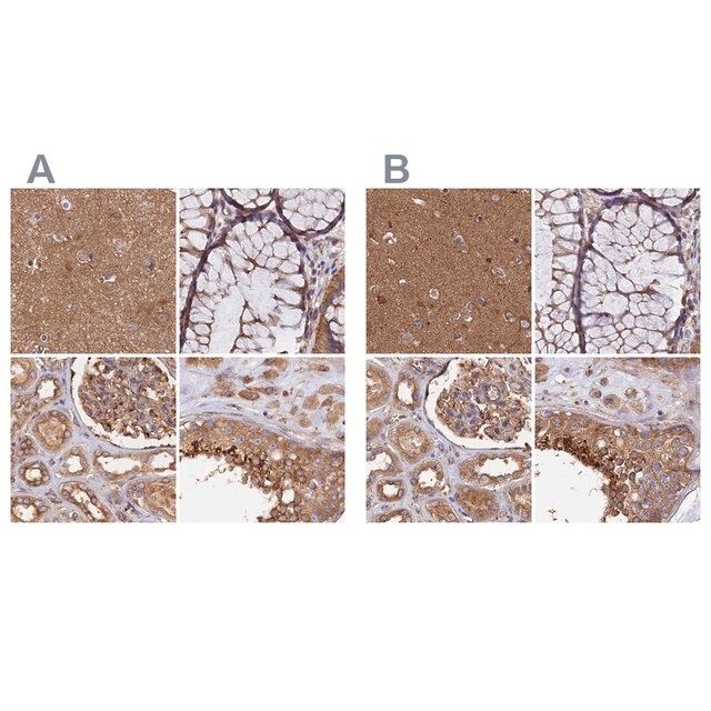 Anti-DCTN2 antibody produced in rabbit