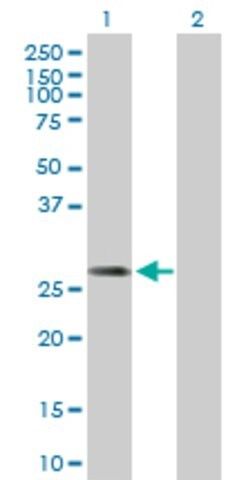 Anti-DCI antibody produced in mouse