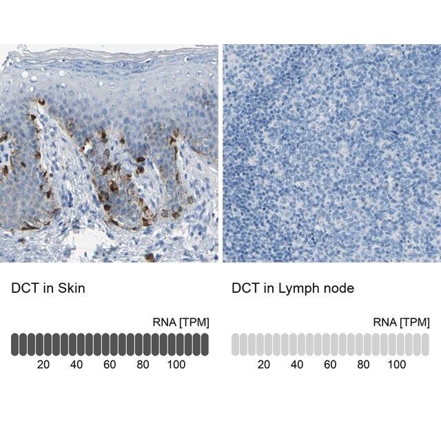 Anti-DCT antibody produced in rabbit