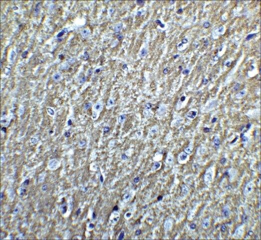 Anti-DCLK3 antibody produced in rabbit