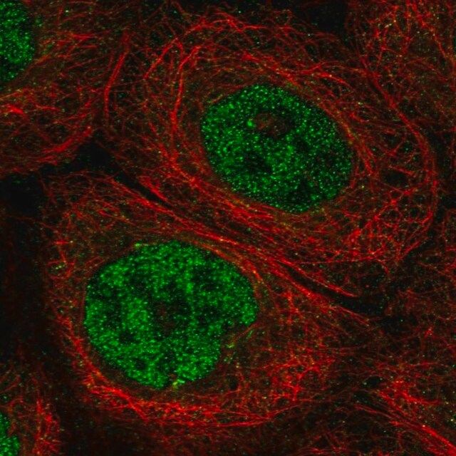 Anti-DCLRE1C antibody produced in rabbit