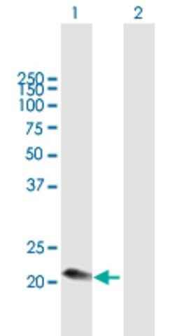 Anti-C1QC antibody produced in mouse