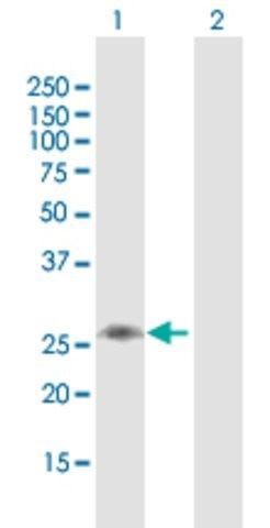 Anti-C1QB antibody produced in mouse