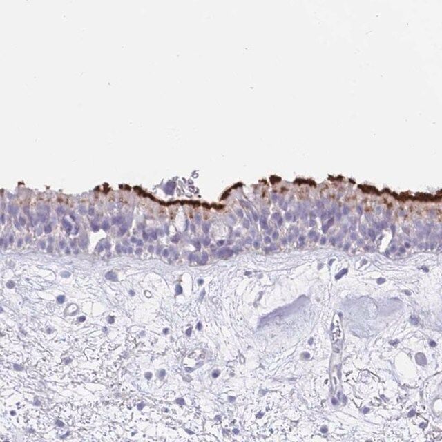 Anti-CPXM2 antibody produced in rabbit