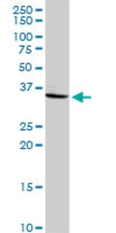 Anti-CRHBP antibody produced in rabbit