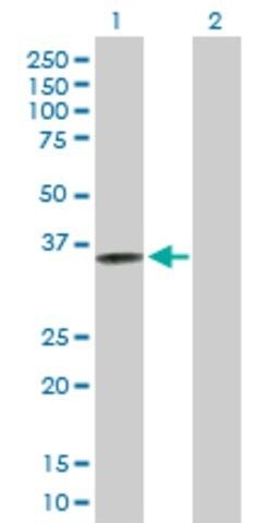 Anti-CRELD2 antibody produced in mouse