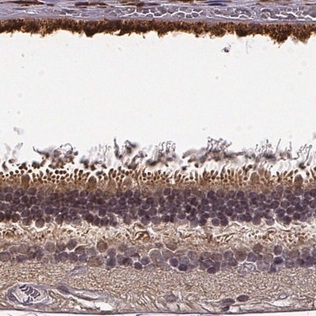 Anti-CRB1 antibody produced in rabbit