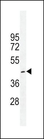 ANTI-CRFR1 (Q103) antibody produced in rabbit