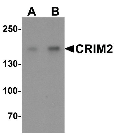 Anti-CRIM2 antibody produced in rabbit