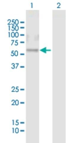 Anti-CRISPLD1 antibody produced in mouse