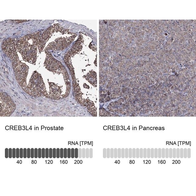 Anti-CREB3L4 antibody produced in rabbit