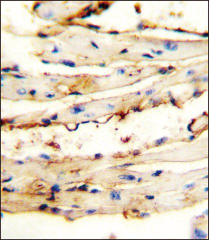 ANTI-CRCT1 (N-TERM) antibody produced in rabbit