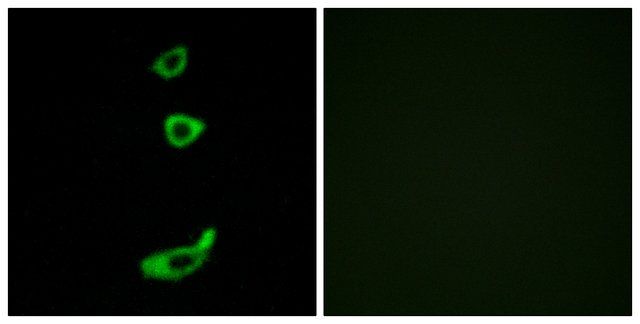 Anti-CRHR1 antibody produced in rabbit