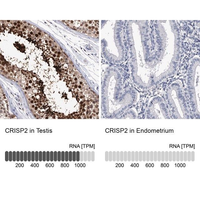 Anti-CRISP2 antibody produced in rabbit